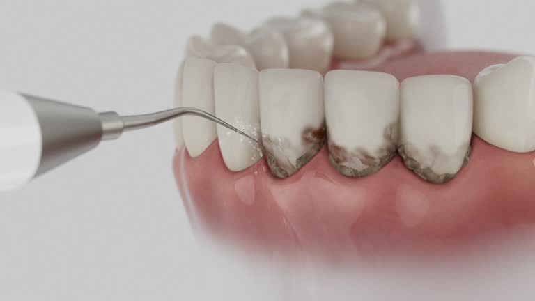 Trusted Dental Crowns And Bridges service in Neodesha, KS - Dentist Open Now